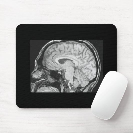 Gehirn MRI Mousepad (Mit Mouse)