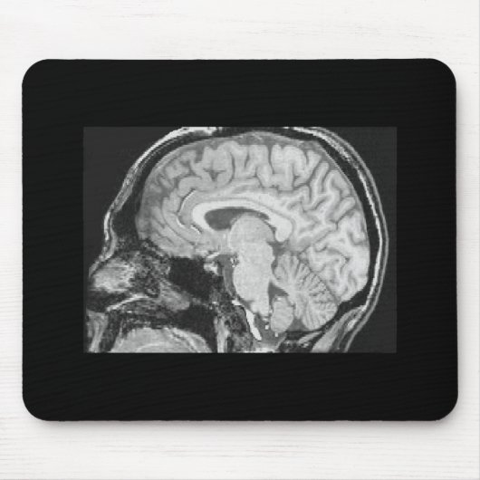 Gehirn MRI Mousepad (Vorne)