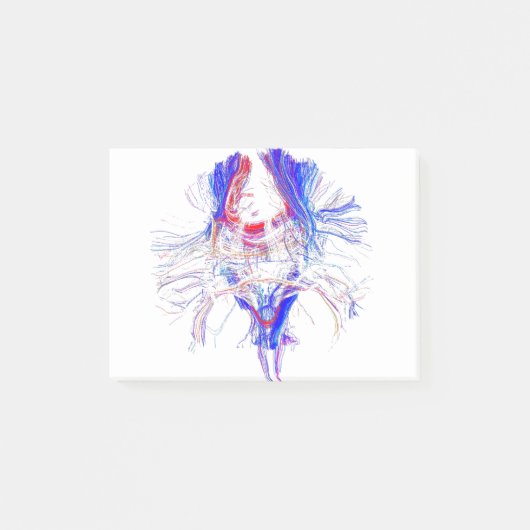 Gehirn und Tracktography Post-it Klebezettel (Vorderseite)