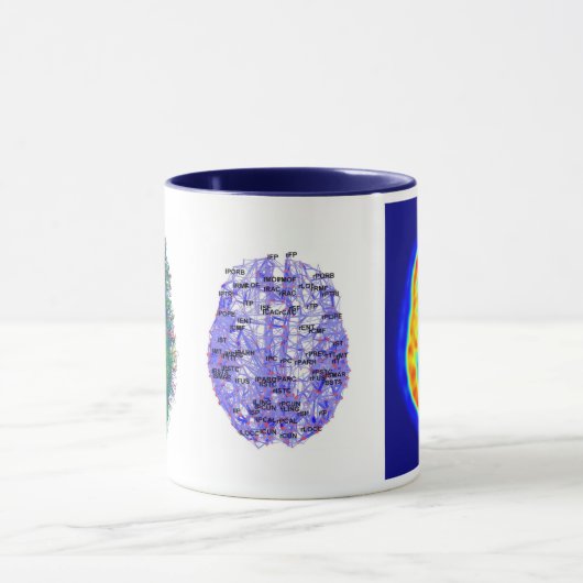 Gehirnbild Tasse (Zentrum)