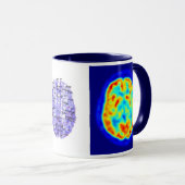 Gehirnbild Tasse (VorderseiteRechts)