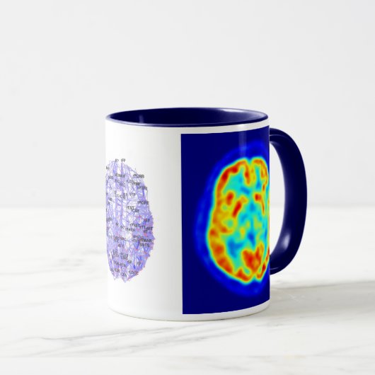 Gehirnbild Tasse (VorderseiteRechts)