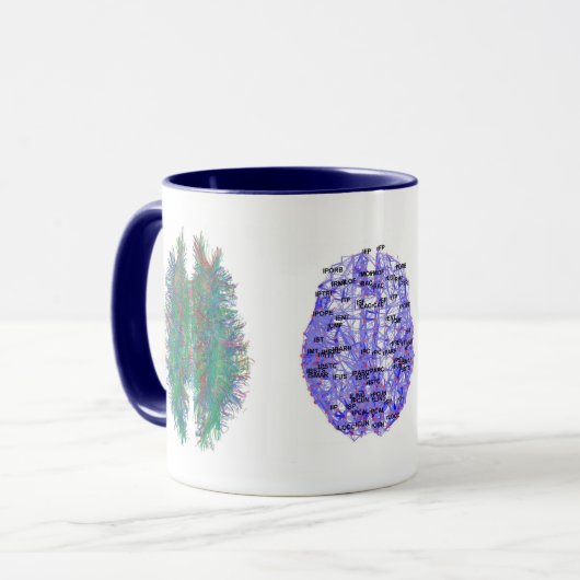 Gehirnbild Tasse (Vorderseite Links)