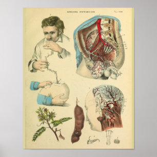 Gehirnchirurgie Kopf Anatomie Kunst Arzt Druck Poster
