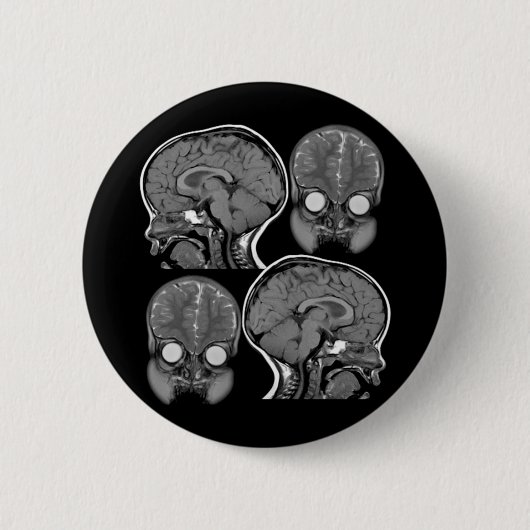 GEHIRNE! (MRI) BUTTON (Vorderseite)