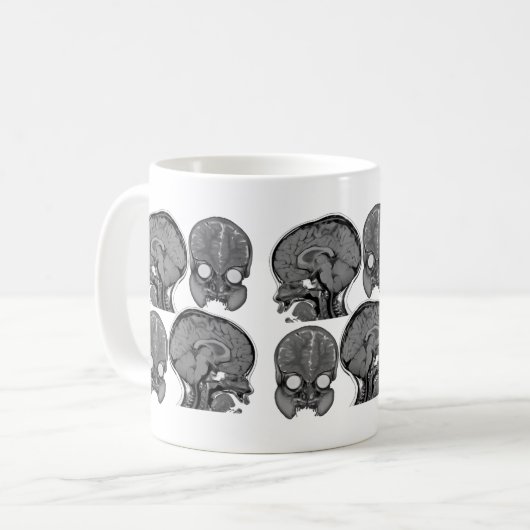 GEHIRNE! (MRI) KAFFEETASSE (Vorderseite Links)