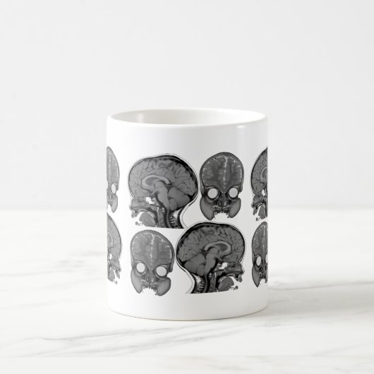 GEHIRNE! (MRI) KAFFEETASSE (Mittel)