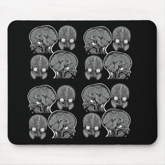 GEHIRNE! (MRI) MOUSEPAD (Vorne)