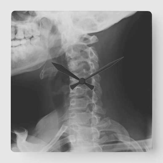Geröntgte 2 quadratische wanduhr (Vorderseite)