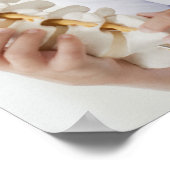 Girl-Holding-Modell im Ärztebüro Poster (Ecke)