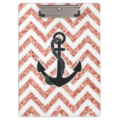 Glitzer Chevrons Klemmbrett (Vorderseite)