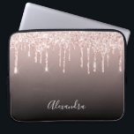 Goldgold-Rose-Glitzer-Tropfen Laptopschutzhülle<br><div class="desc">Ein elegantes,  mädchenhaftes und glamouröses Pad-Gehäuse. Imitate Rose Gold Glitzer Tropfen,  malen Tropfen. Schwarz-brauner Ober-Hintergrund. Geben Sie Ihren Namen ein,  der mit einem modernen handgeschriebenen Stilskript geschrieben wurde. Graue Buchstaben.</div>