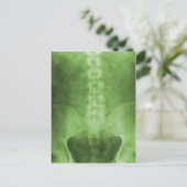 Green Digital X-Ray Art Postkarten (Stehend Vorderseite)