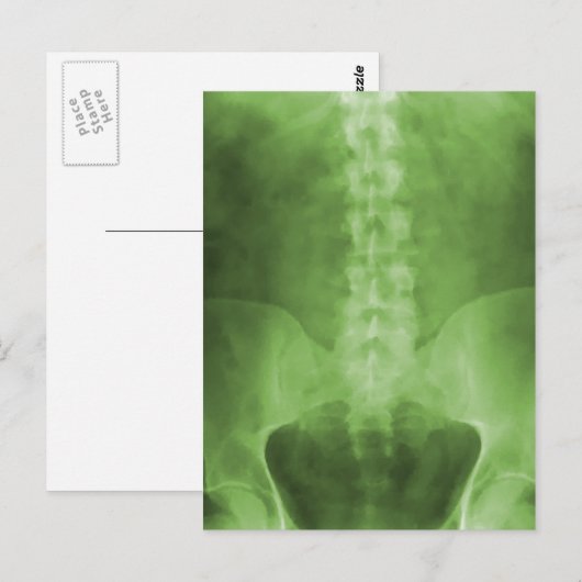 Green Digital X-Ray Art Postkarten (Vorne/Hinten)