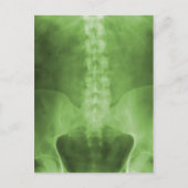 Green Digital X-Ray Art Postkarten (Vorderseite)