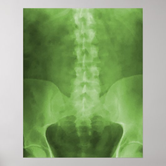 Green Digital X-Ray Art Print Poster (Vorne)