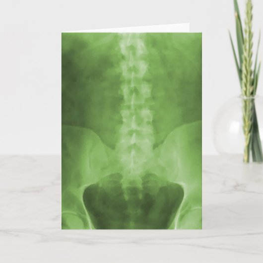 Grüne Digital-Röntgenstrahl-Kunst-Gruß-Karte Karte (Vorderseite)