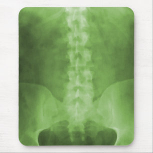Grüne Digital-Röntgenstrahl-Kunst Mousepad