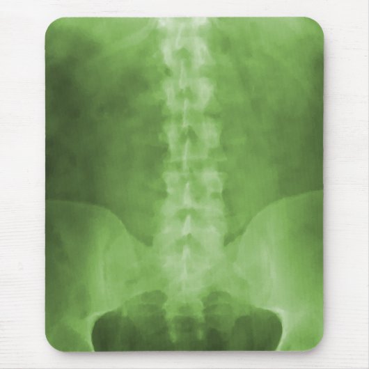 Grüne Digital-Röntgenstrahl-Kunst Mousepad (Vorne)