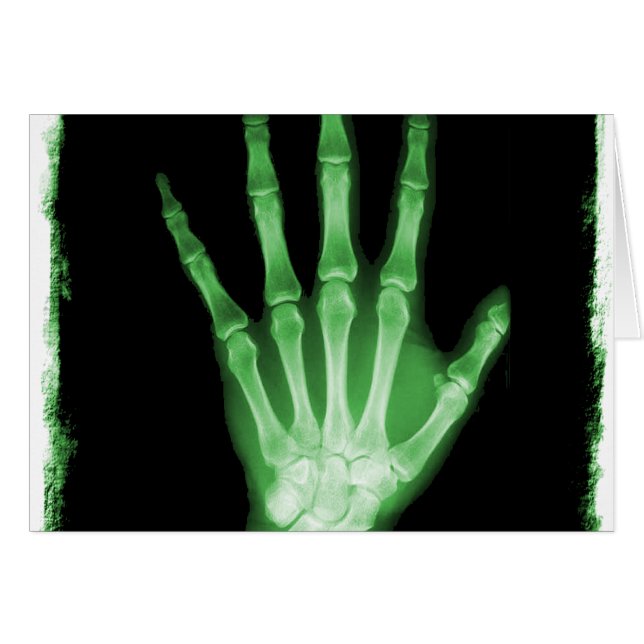 Grüne Röntgenstrahl-Skelett-Hand (Vorderseite (Horizontal))