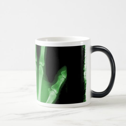 Grüne Röntgenstrahl-Skelett-Hand Verwandlungstasse (Rechts)