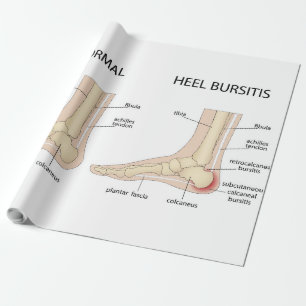 Haglund-Deformität Geschenkpapier