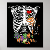 Halloween Candy Skeleton Rib Cage X-Ray Poster (Vorne)