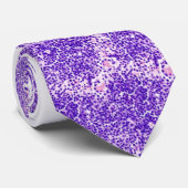 Hals-Krawatte - mehrfacher Myeloma Krawatte (Gerollt)