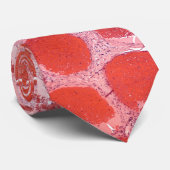 Hämangiom Krawatte (Gerollt)