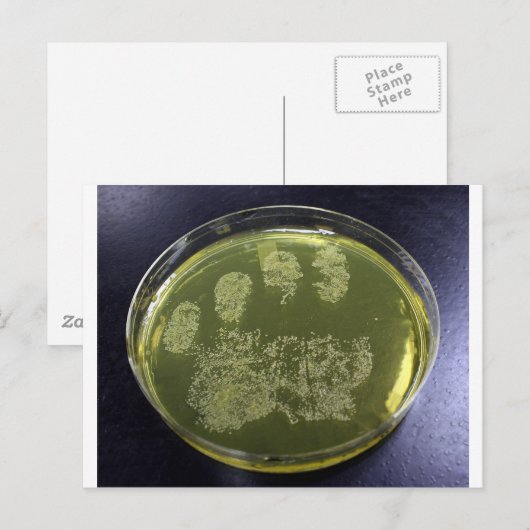 Hand Petri Dish Bacteria Postkarte (Vorne/Hinten)