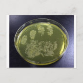 Hand Petri Dish Bacteria Postkarte (Vorderseite)