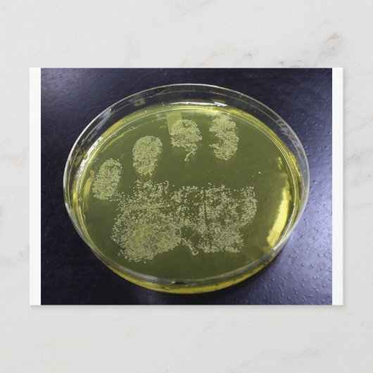 Hand Petri Dish Bacteria Postkarte (Vorderseite)