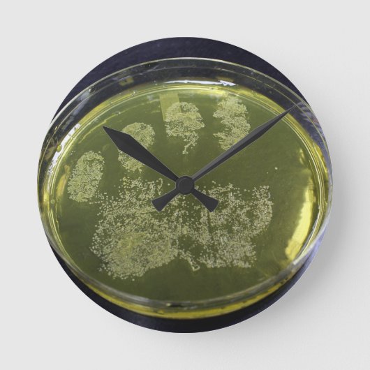 Hand Petri Dish Bacteria Runde Wanduhr (Vorderseite)