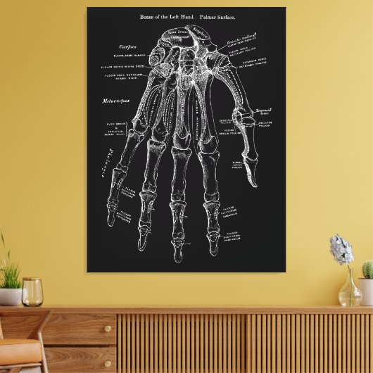 Handanatomie Große Leinwand Mauer Art 36x48" (Insitu (Wohnzimmer))