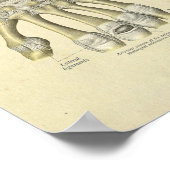 Handgelenkhalter Anatomie Knochen drucken Poster (Ecke)