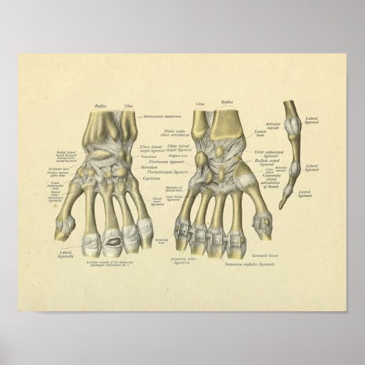 Handgelenkhalter Anatomie Knochen drucken Poster (Vorne)