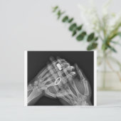 Handhaltung Postkarte (Stehend Vorderseite)