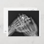 Handhaltung Postkarte (Vorne/Hinten)