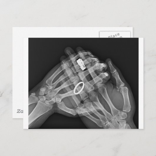 Handhaltung Postkarte (Vorne/Hinten)