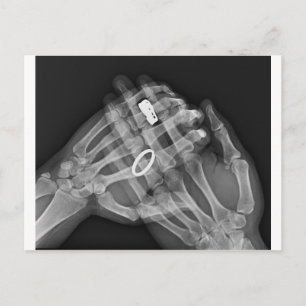 Handhaltung Postkarte