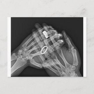 Handhaltung Postkarte