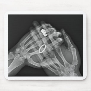 Handholding Mousepad