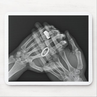 Handholding Mousepad