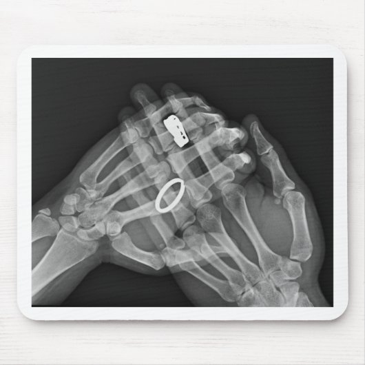 Handholding Mousepad (Vorne)