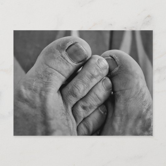 Hässliche Füße Postkarte (Vorderseite)