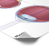 Häufig Augenerkrankungen Poster (Ecke)