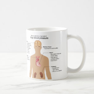 Hauptkomplikationen hoher des Blutdruck-Diagramms Kaffeetasse