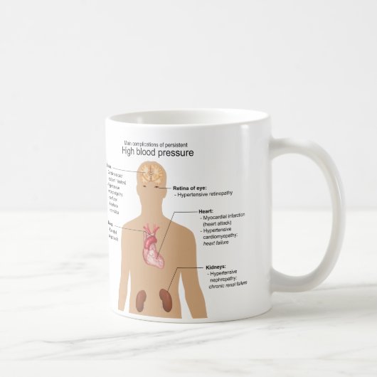 Hauptkomplikationen hoher des Blutdruck-Diagramms Kaffeetasse (Rechts)