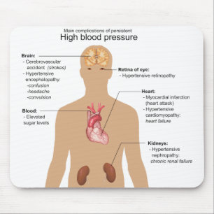 Hauptkomplikationen hoher des Blutdruck-Diagramms Mousepad