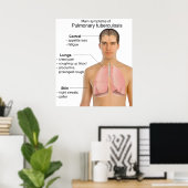 Hauptsymptome der Lungentuberkulose Poster (Heimbüro)